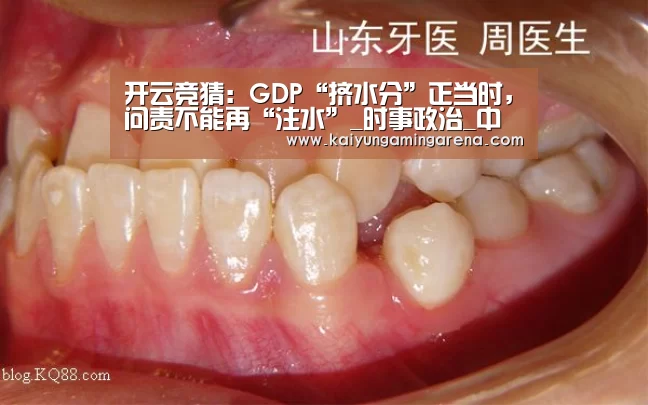 开云篮球
